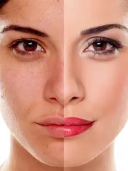 manage-hyperpigmentation jpg